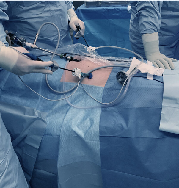 qio process image 16